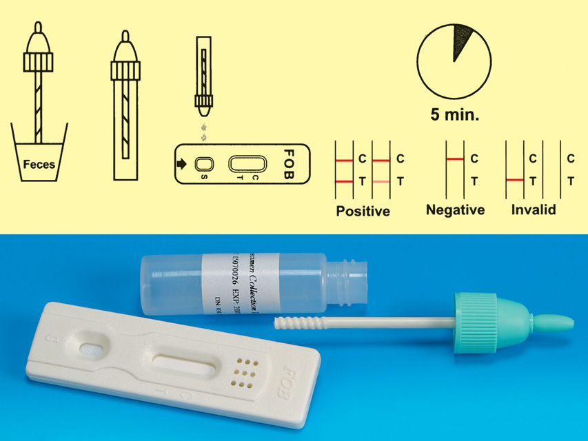 TEST FOB - Sangue occulto nelle feci