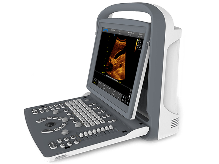 ECOGRAFO CHISON ECO2 B/N - 1 connettore sonda